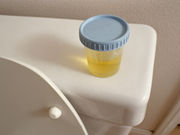 Urine drug screens can be false-positive for amphetamines after ingestion of aripiprazole