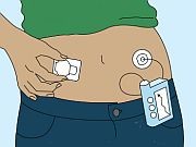 Modern insulin pump technologies could be further improved by adopting a more rigorous