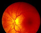 Gene therapy can rapidly improve eyesight for patients who've lost their vision from Leber congenital amaurosis