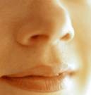 Patients with facial paralysis may benefit from cosmetic lip augmentation
