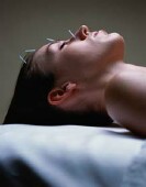 Acupuncture appears to be more efficacious than oral medication for treating hot flashes in breast cancer survivors