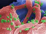 HIV can continue to multiply in patients who are responding well to antiretroviral therapy