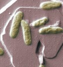 The incidence of reported infections with Escherichia coli O157 and a common strain of Salmonella bacteria have decreased