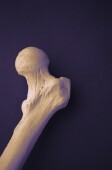 High doses of vitamin D do not appear to protect postmenopausal women from osteoporosis