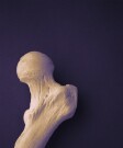 Extra calcium may not protect aging bones after all. The findings appear online in two reviews published online Sept. 29 in The BMJ.