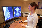 A majority of women who receive false positives on mammography experience distress and anxiety