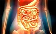 Colectomy may extend the lives of older adults with ulcerative colitis
