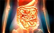 Two experimental therapies show promise in management of Crohn's disease.