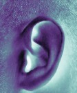 Cochlear implants not only boost hearing in seniors with severe hearing loss