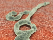 The levels of Ebola virus in a patient's blood can strongly predict the mortality risk