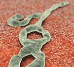 Early results suggest an experimental Ebola vaccine triggers an immune response and is safe to use. The findings were published online Jan. 28 in the New England Journal of Medicine.