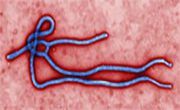 An experimental Ebola vaccine may have prevented the disease in a doctor who was at high risk of infection