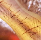 A low-calorie diet may improve heart rate variability in obese patients with type 2 diabetes