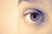 Use of the label "pink eye" versus "eye infection" is associated with increased parent intent to use antibiotics despite parents being informed about antibiotics' ineffectiveness for treating symptoms