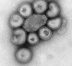 A mutation in the H3N2 virus led to a mismatch between it and the H3N2 strain used to create the 2014-2015 vaccine