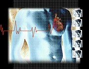Recommendations have been developed for the management of adult patients with supraventricular tachycardia. The guideline was published online Sept. 23 in the <i>Journal of the American College of Cardiology</i>.