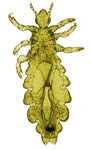 Most lice populations have point mutations that are linked to pyrethroid resistance