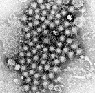 A hepatitis C virus screening program diagnosed chronic HCV infection in 4.2 percent of baby boomers tested