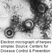 A new study in mice hints at the success of a vaccine against the herpes simplex virus. The research was published online March 9 in <i>eLife</i>.