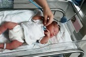 Newborns with neonatal abstinence syndrome are more likely to be readmitted to the hospital than those without the condition
