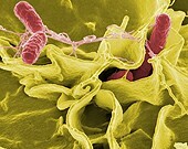 Antibiotic-resistant infections from foodborne germs still cause about 440