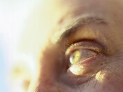 Patients with vitamin D deficiency should be evaluated for dry eye syndromes