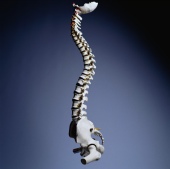For patients undergoing lumbar spine surgery for degenerative disease