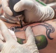 Picosecond-domain Nd:YAG laser incorporating a potassium-titanyl-phosphate frequency-doubling crystal is safe and effective for removing decorative tattoos