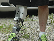 Scientists say they're making progress toward developing a motorized artificial lower leg that automatically adjusts to changes in movement