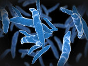 Although antibiotics have largely eradicated tuberculosis in the United States in recent decades