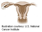Transvaginal sonography
