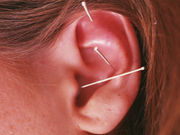 Acupuncture may improve management of hot flashes in women with breast cancer