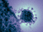 Middle East respiratory syndrome coronavirus infections are frequently associated with health care settings