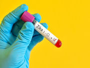 The U.S. Food and Drug Administration has issued an Emergency Use Authorization for a diagnostic tool for Zika virus that will be distributed to qualified laboratories