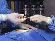 For patients undergoing hip or knee arthroplasty