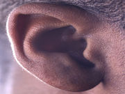 Hearing loss is associated with higher medical costs for late middle-aged adults