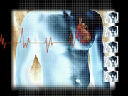 Patients with pacemakers and sleep apnea are at much greater risk for atrial fibrillation