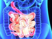 A low-residue diet prior to a colonoscopy may be better than clear liquids only
