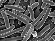 The first case of a patient infected with a superbug resistant to a last-resort antibiotic has been documented in the United States. The report was published online May 26 in Antimicrobial Agents and Chemotherapy.