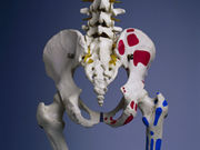 Many patients in their 60s who have hip arthroscopy need total hip arthroplasty within two years