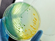 An experimental antibiotic has shown promise against methicillin-resistant <i>Staphylococcus aureus</i> in animals