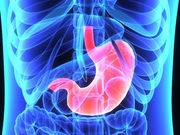 <i>Helicobacter pylori</i> infection is associated with metabolic syndrome