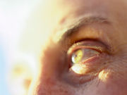 Nonablative radiofrequency treatment can improve skin elasticity around the eye area
