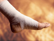 A new type of plaster cast might help older adults avoid surgery for unstable ankle fractures