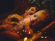 While a birthing pool during the early stages of labor may offer some advantages