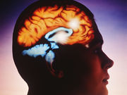 More than one in 10 stroke survivors develop epilepsy