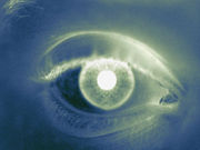 For eyes experiencing substantial visual loss after macular laser photocoagulation treatment for diabetic macular edema