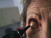 Stem cells may offer new hope for patients with age-related macular degeneration