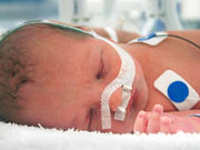 Among infants born from 23 to 34 weeks of gestation