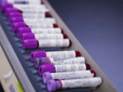 A blood-based genome testing service provides accurate results within 72 hours